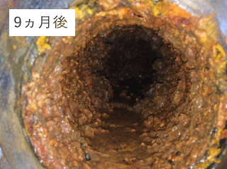 BW_閉塞改善9ヶ月後